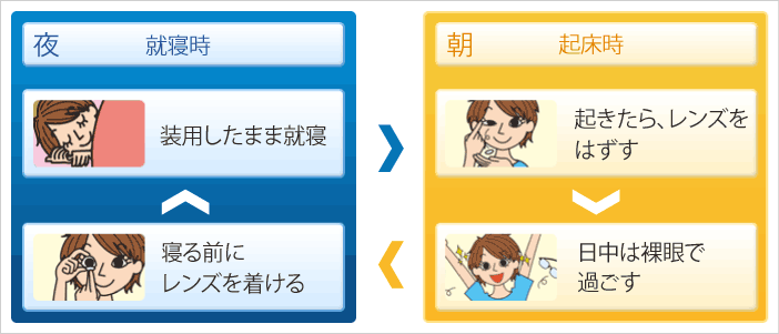 オルソケラトロジーレンズ「ブレスオーコレクト」 - 久喜かわしま眼科